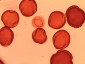 Pollen Sample Analysis - Honey Glen